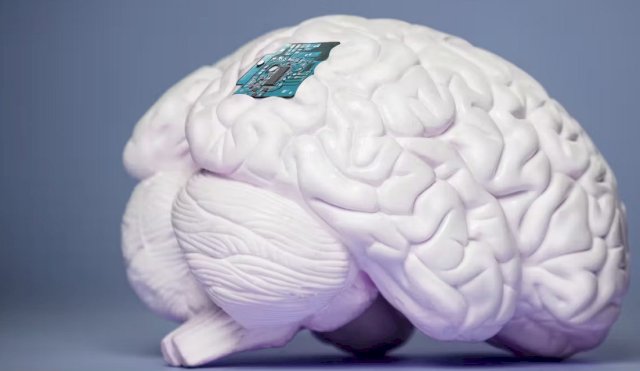 CEREBRO